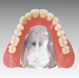 金属床義歯.jpg