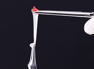 治療部位への応用